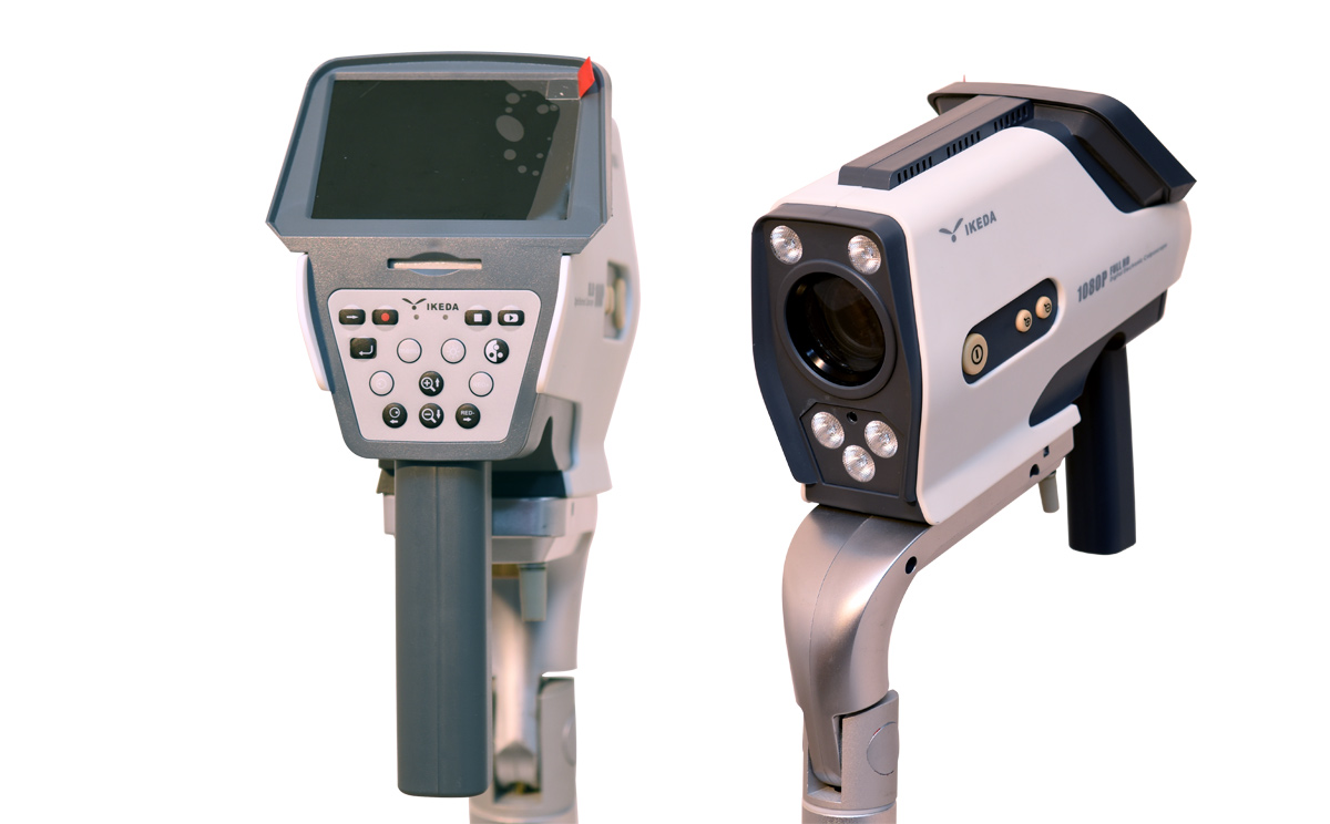 數(shù)碼電子陰道鏡攝像機(jī)特點(diǎn) 數(shù)碼電子陰道鏡攝像機(jī)特點(diǎn)