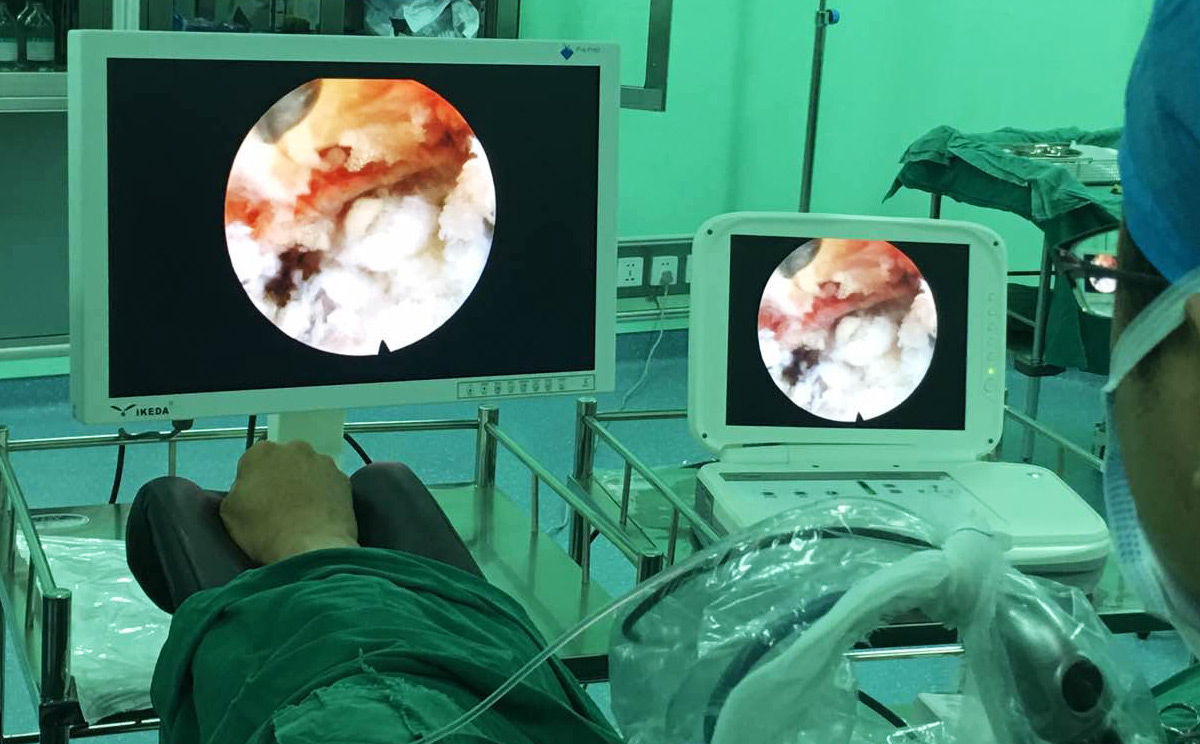 如何維護保養(yǎng)內(nèi)窺鏡顯示器？