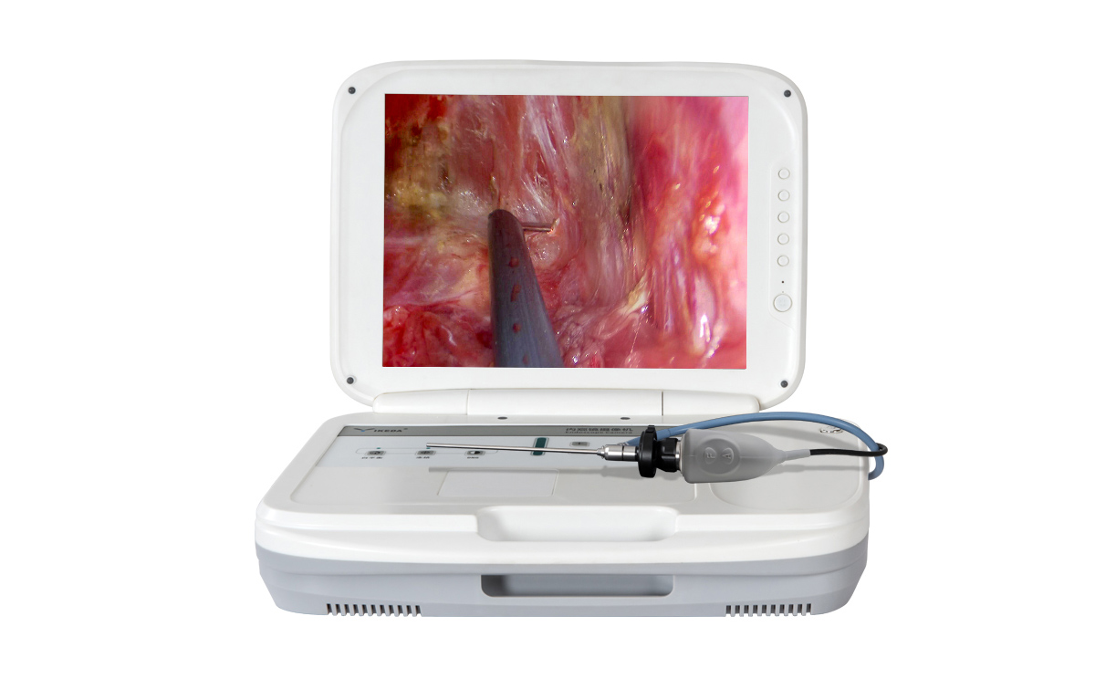 醫(yī)用內(nèi)窺鏡攝像機(jī)的優(yōu)點(diǎn) 醫(yī)用內(nèi)窺鏡攝像機(jī)的優(yōu)點(diǎn)