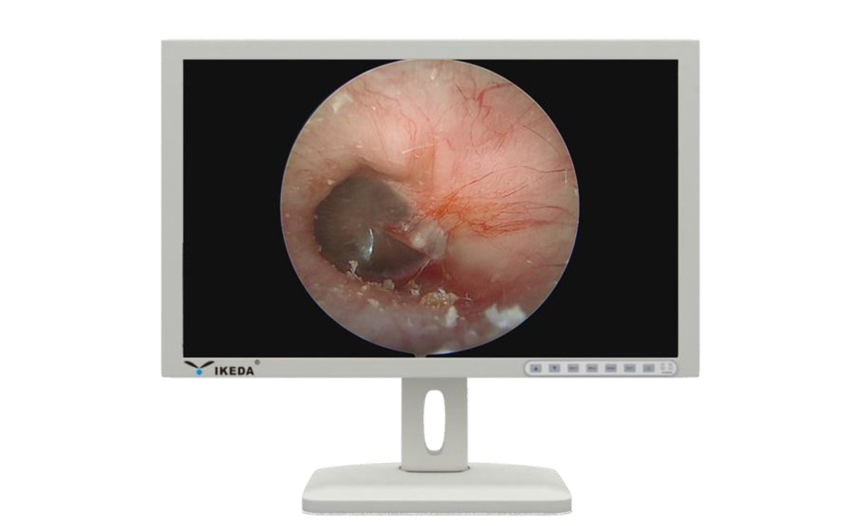 內(nèi)窺鏡監(jiān)視器功能特點(diǎn) 內(nèi)窺鏡監(jiān)視器功能特點(diǎn)