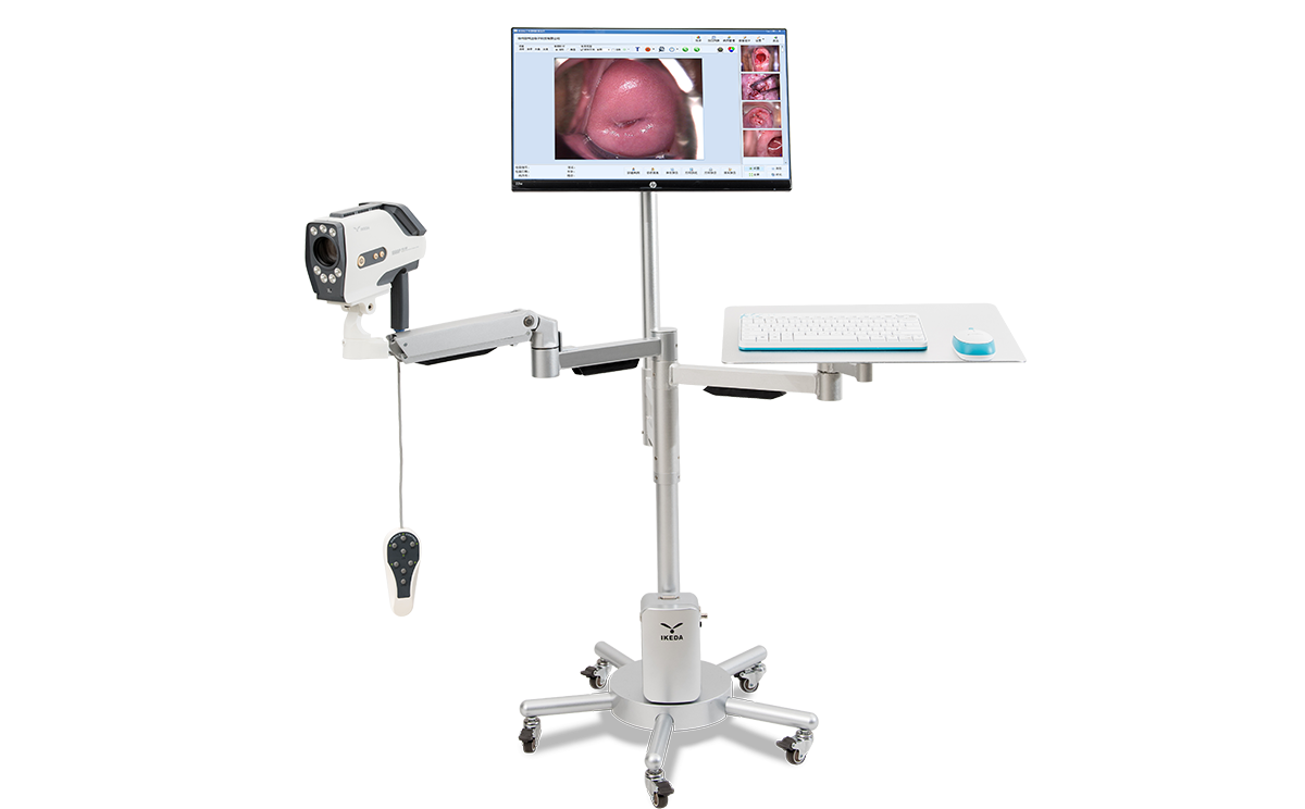 數(shù)碼電子陰道鏡如何選擇？根據(jù)醫(yī)院等級(jí)需求選擇合適的