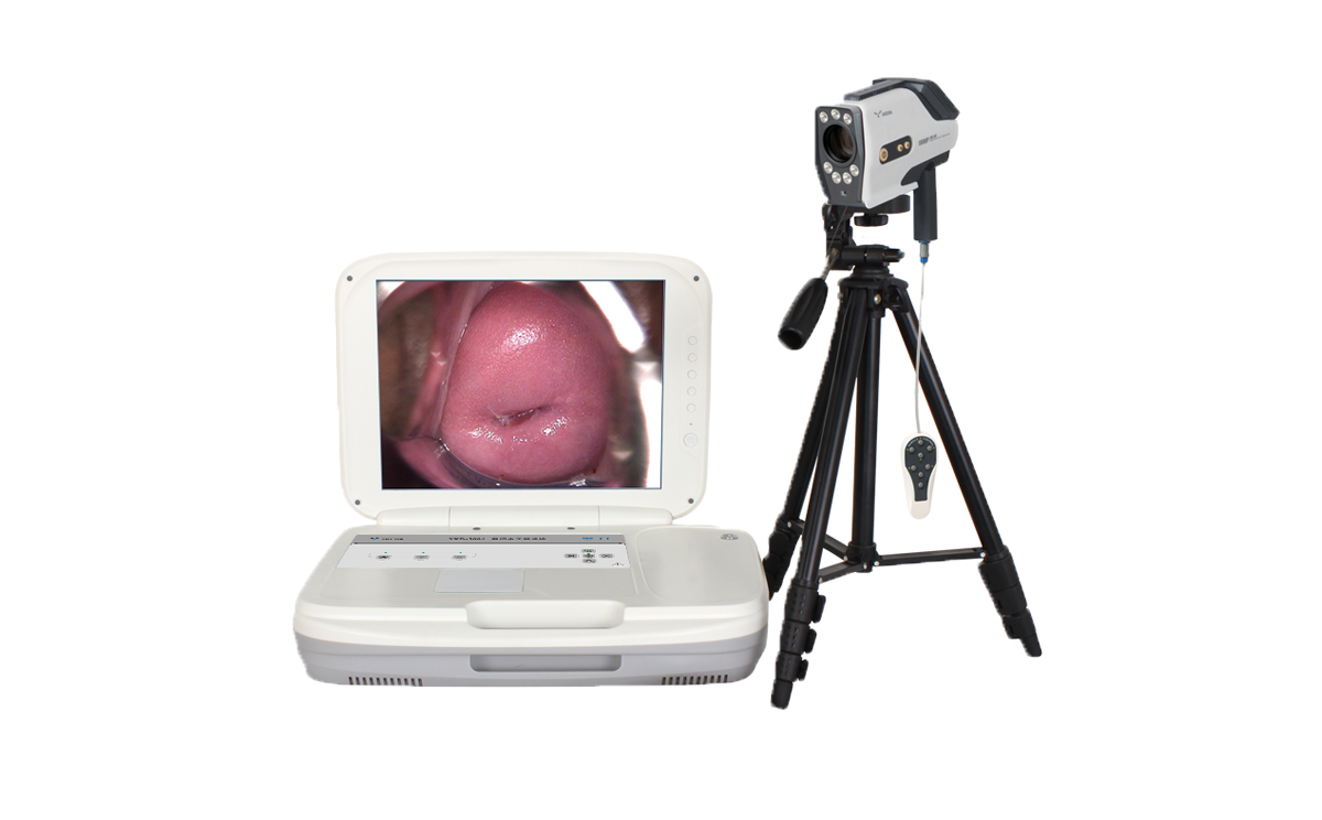 數(shù)碼電子陰道鏡如何選擇？根據(jù)醫(yī)院等級(jí)需求選擇合適的