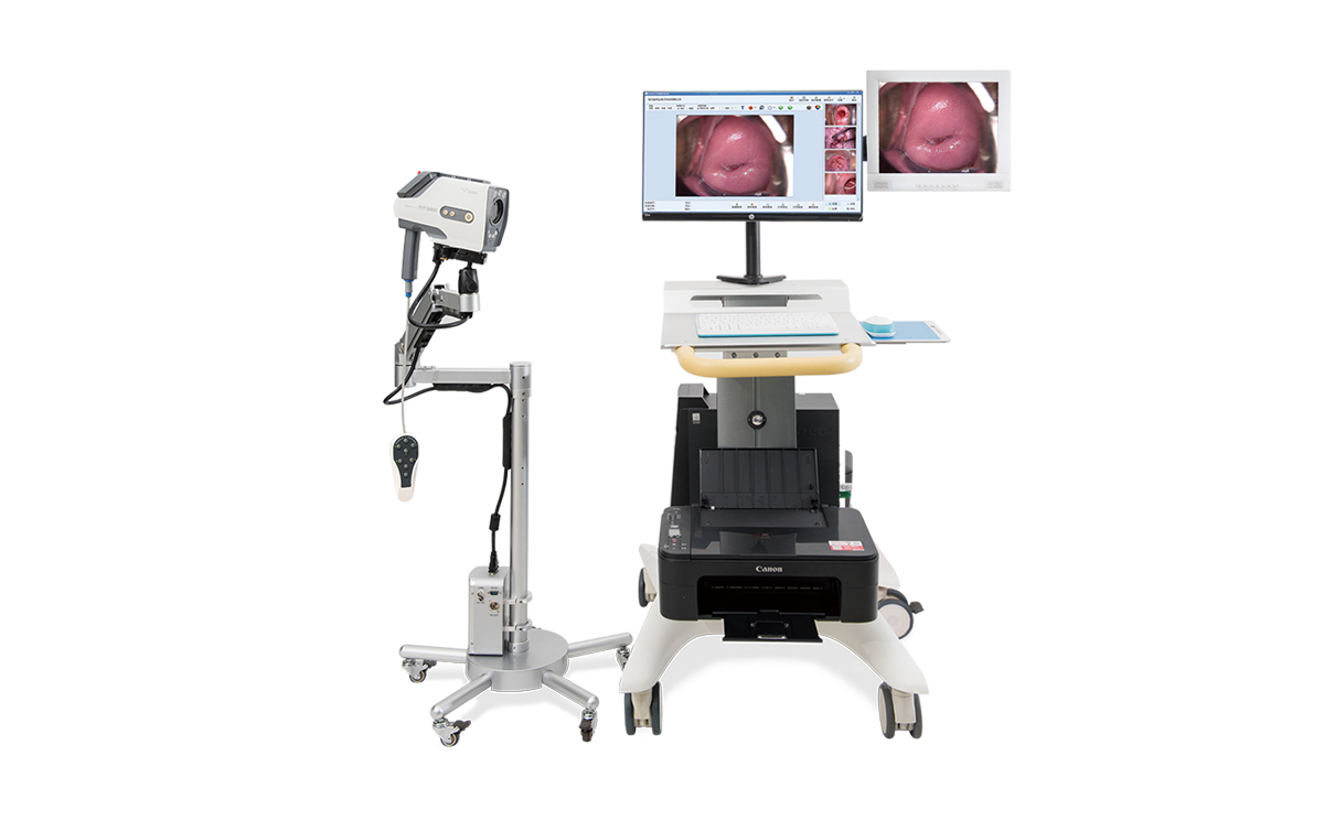 數(shù)碼電子陰道鏡如何選擇？根據(jù)醫(yī)院等級(jí)需求選擇合適的