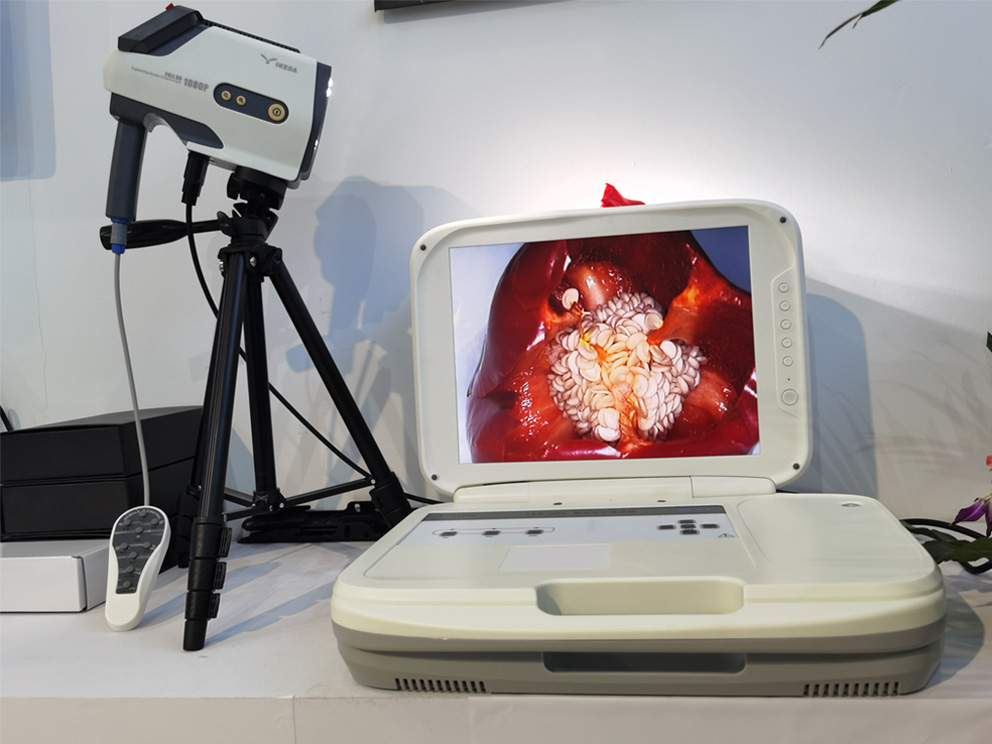 陰道鏡檢查：電子陰道鏡檢查過(guò)程疼嗎？