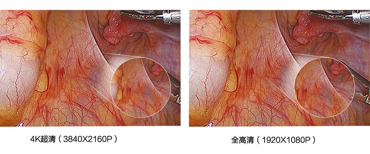 益柯達(dá)4K超高清內(nèi)窺鏡攝像系統(tǒng)
