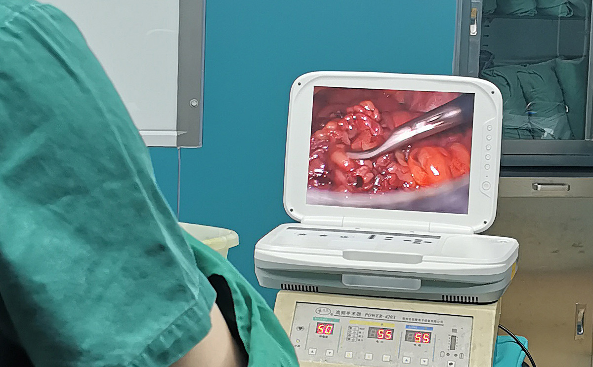 【腹腔鏡篇】腹腔鏡疝氣手術(shù)，您知道嗎？