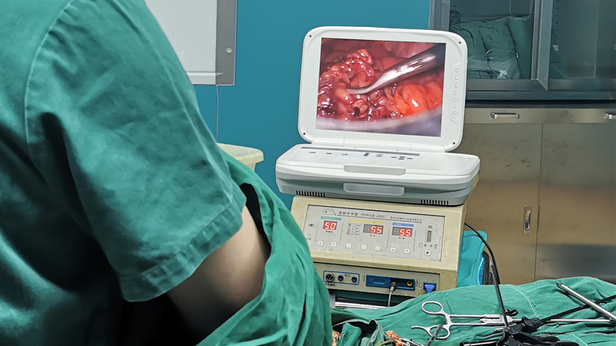 內(nèi)窺鏡攝像機(jī)適用于哪些科室范圍？