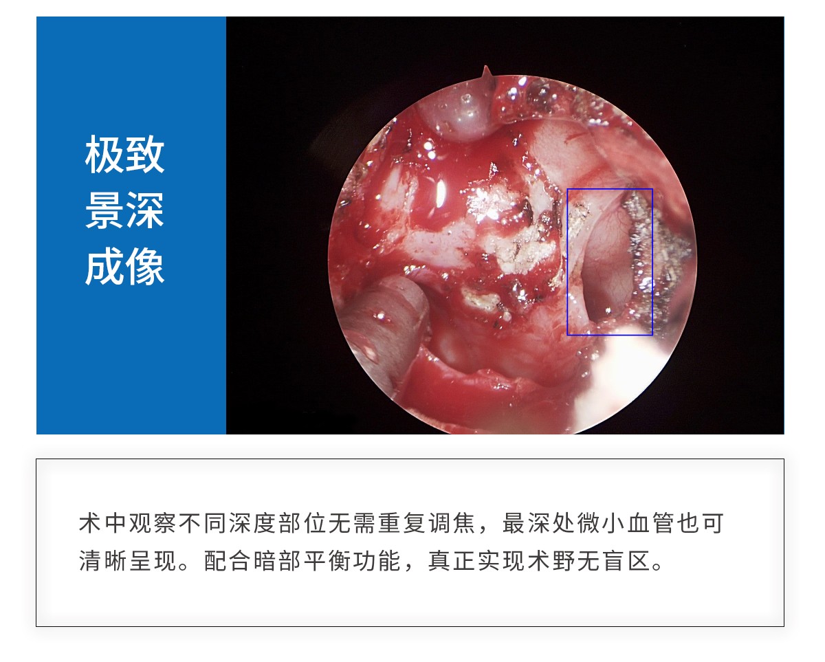 【4K醫(yī)用內(nèi)窺鏡攝像系統(tǒng)】您的第一臺(tái)“4K”找到了嗎？