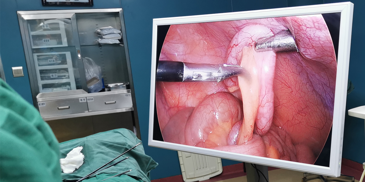 【4K醫(yī)用內(nèi)窺鏡攝像系統(tǒng)】您的第一臺(tái)“4K”找到了嗎？