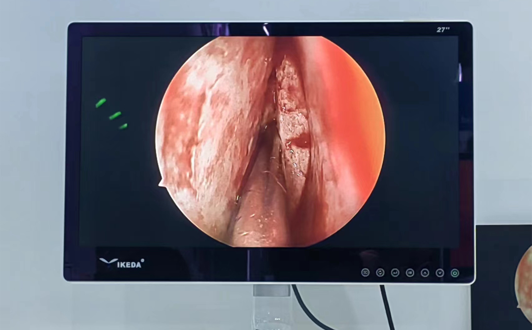 醫(yī)用監(jiān)視器 醫(yī)用監(jiān)視器