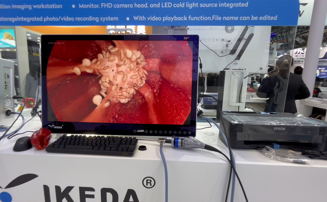 4K醫(yī)用內窺鏡攝像系統(tǒng) 4K醫(yī)用內窺鏡攝像系統(tǒng)