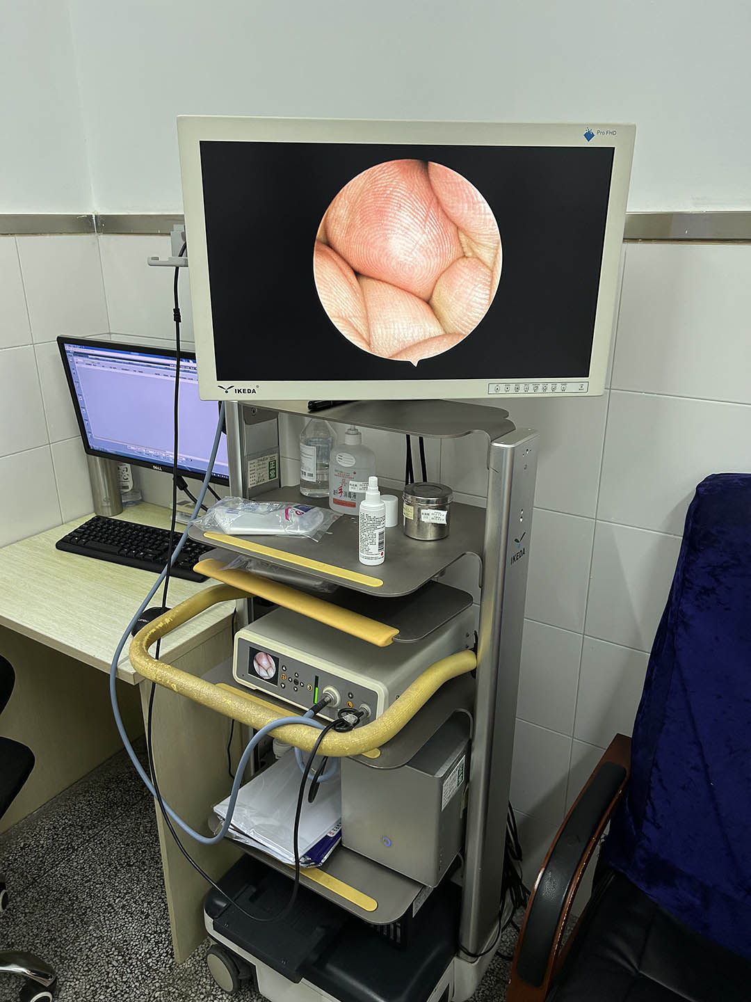 醫(yī)用內(nèi)窺鏡攝像系統(tǒng) 醫(yī)用內(nèi)窺鏡攝像系統(tǒng)