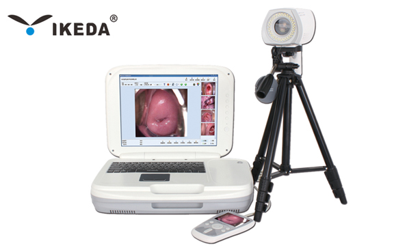 數(shù)碼電子陰道鏡常見(jiàn)的故障及原因