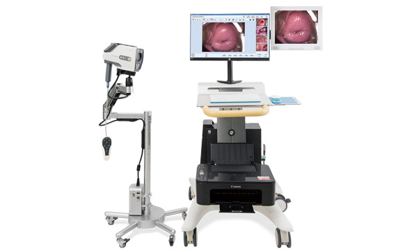 如何選擇數(shù)碼電子陰道鏡？