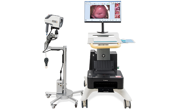 電子陰道鏡鏡頭哪家好？