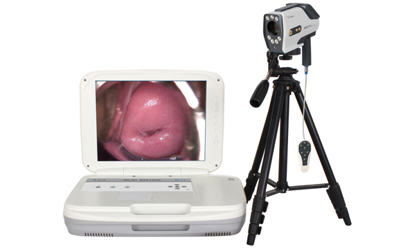 電子陰道鏡操作要點(diǎn)是什么？