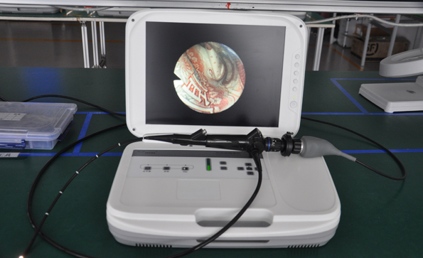 纖維支氣管鏡檢查的目的是什么？