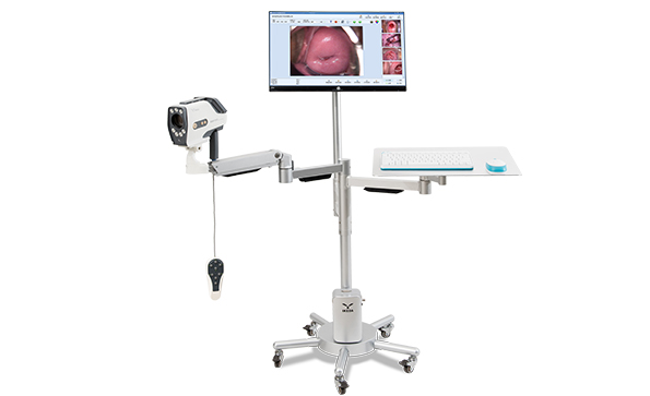 數(shù)碼電子陰道鏡如何選擇？根據(jù)醫(yī)院等級需求選擇合適的