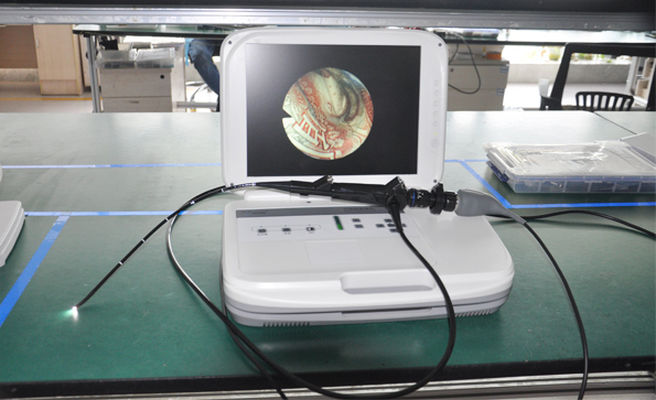 耳鼻喉內(nèi)窺鏡怎樣檢查咽喉？