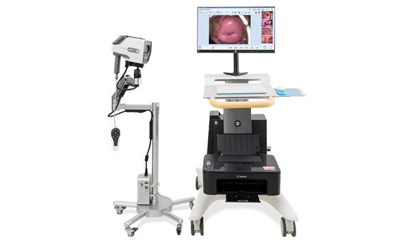婦科電子陰道鏡檢查的作用有哪些？