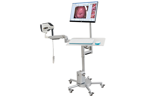 電子陰道鏡檢查結(jié)果有哪些？多長時間出結(jié)果？