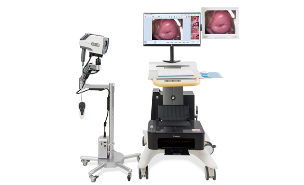 電子陰道鏡廠家介紹：電子陰道鏡使用過程容易出現(xiàn)哪些問題？