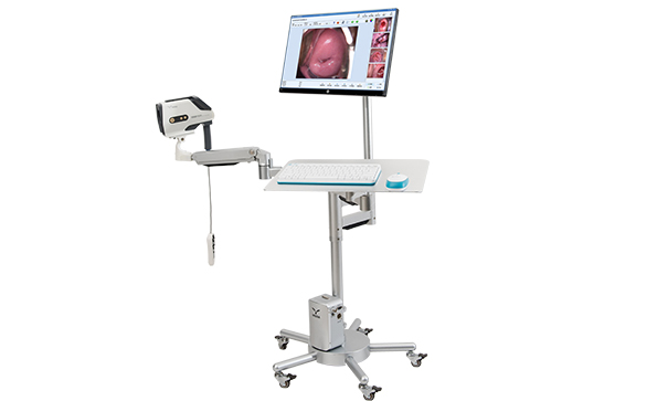 電子陰道鏡檢查都有哪些禁忌的問題？