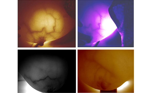 紅外乳腺檢查儀檢查乳腺準嗎？如何檢查呢？