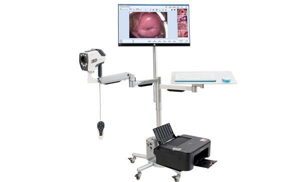 陰道鏡檢查的應用價值是什么？觀察項目有哪些？