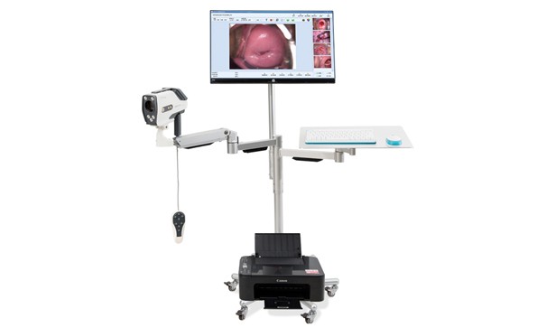 陰道鏡檢查需要注意哪些？陰道鏡檢查需要避免4個時期