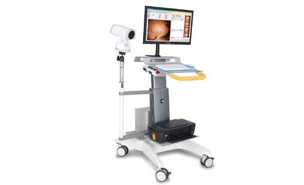 紅外乳腺檢查儀有哪些品牌？