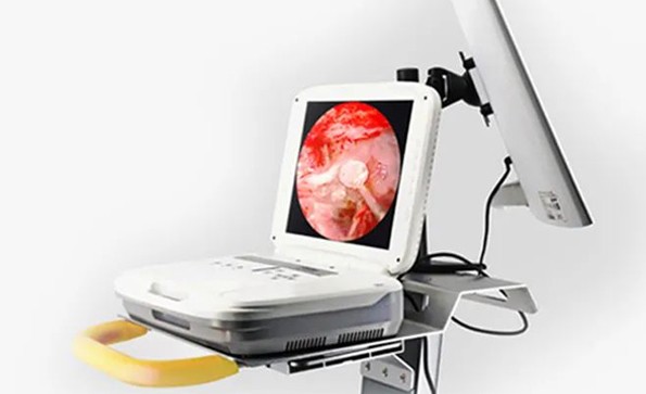 YKD-9003內(nèi)窺鏡攝像機應用：鼻中隔矯正+蝶竇囊腫切除