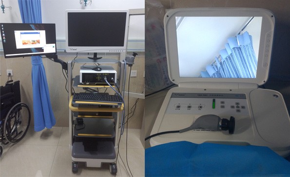 裝機動態(tài)|益柯達內(nèi)窺鏡攝像機裝機完成