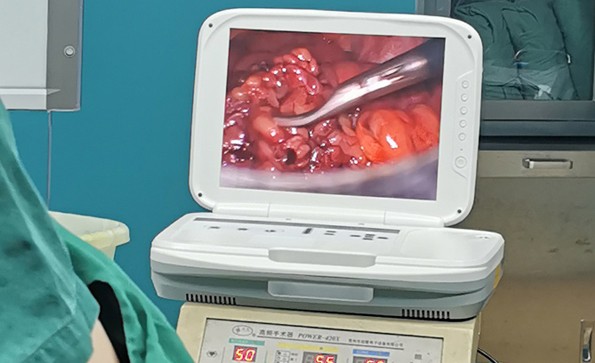 腹腔鏡檢查是怎么做的？