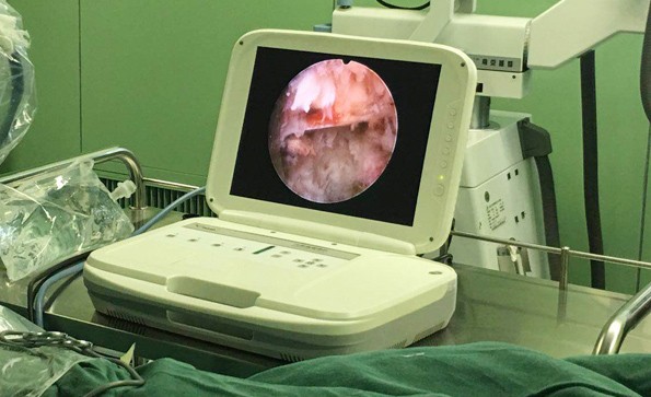 椎間孔鏡手術(shù)治療的適應(yīng)范圍有哪些？