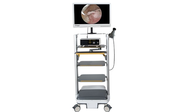 【宮腔鏡】宮腔鏡子宮肌瘤切除術(shù)