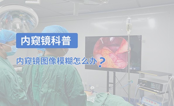 內(nèi)窺鏡科普：內(nèi)窺鏡圖像模糊怎么辦？