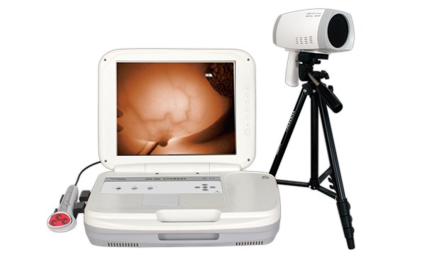 乳腺癌形成原因有哪些？多發(fā)生在哪些群體？