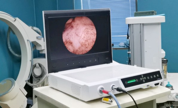 一文了解關(guān)節(jié)鏡系統(tǒng)的構(gòu)成、應(yīng)用、操作流程